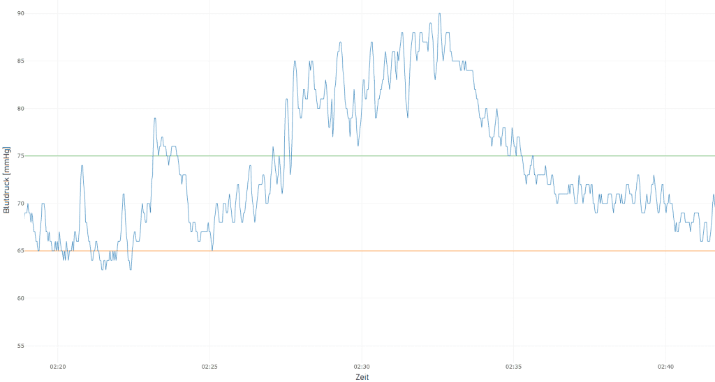 Mean arterial blood pressure (MAP)