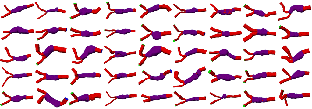 Deep Learning gestützte Extraktion anatomischer Strukturen für Patient*innen-Kohorten am Beispiel von abdominalen Aortenaneurysmen.