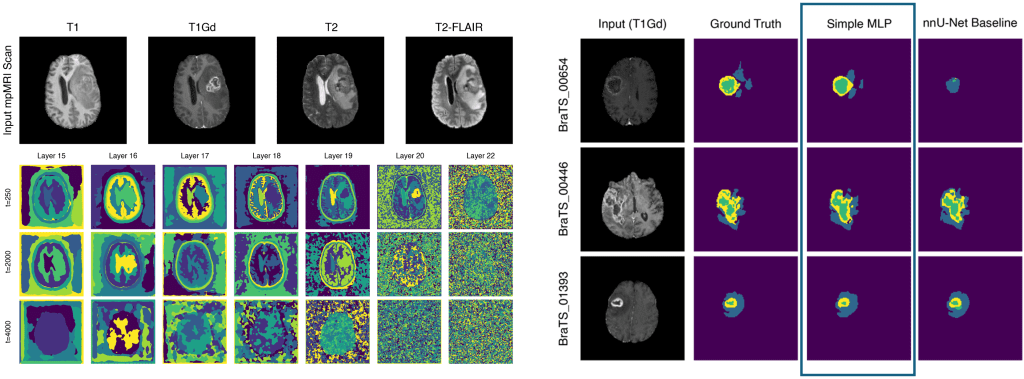 Gelernte visuelle Repräsentationen des BRATS Datensatzes für ein Diffusionsmodell (links) und daraus abgeleitete Segmentierungen eines Gehirntumors für nur zehn Trainingsbilder (rechts).
Learned Visual Representations of the BRATS dataset from Diffusion (left) and derived segmentations for only ten training slices (right).