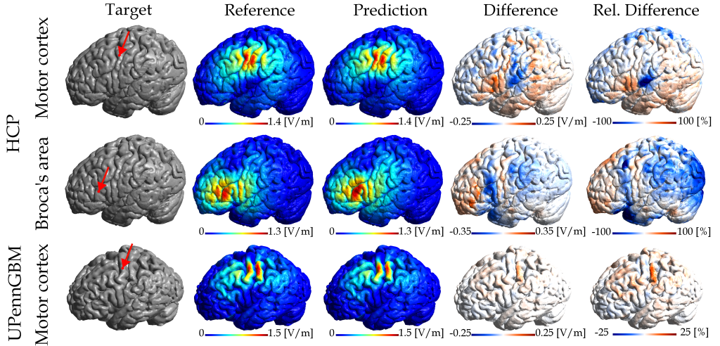 Gehirnscans mit verschiedenen Vergleichsarten