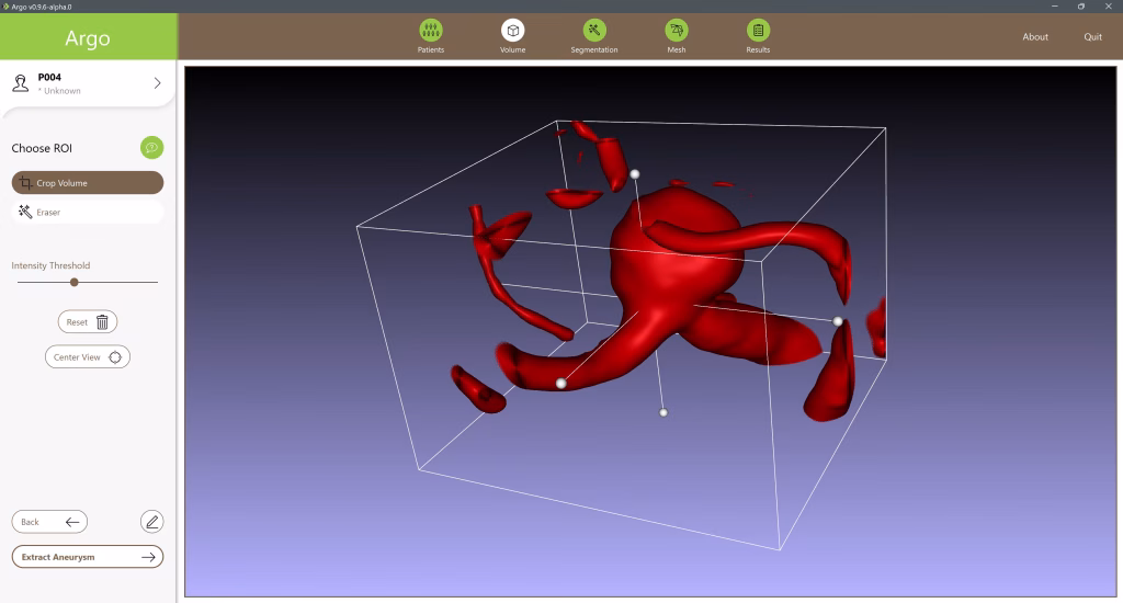 Abb. 2: Zuschneiden der relevanten Region in den 3D-Bilddaten.