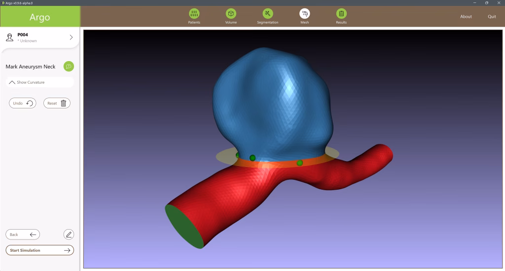 3D-Modell eines Aneurysmas