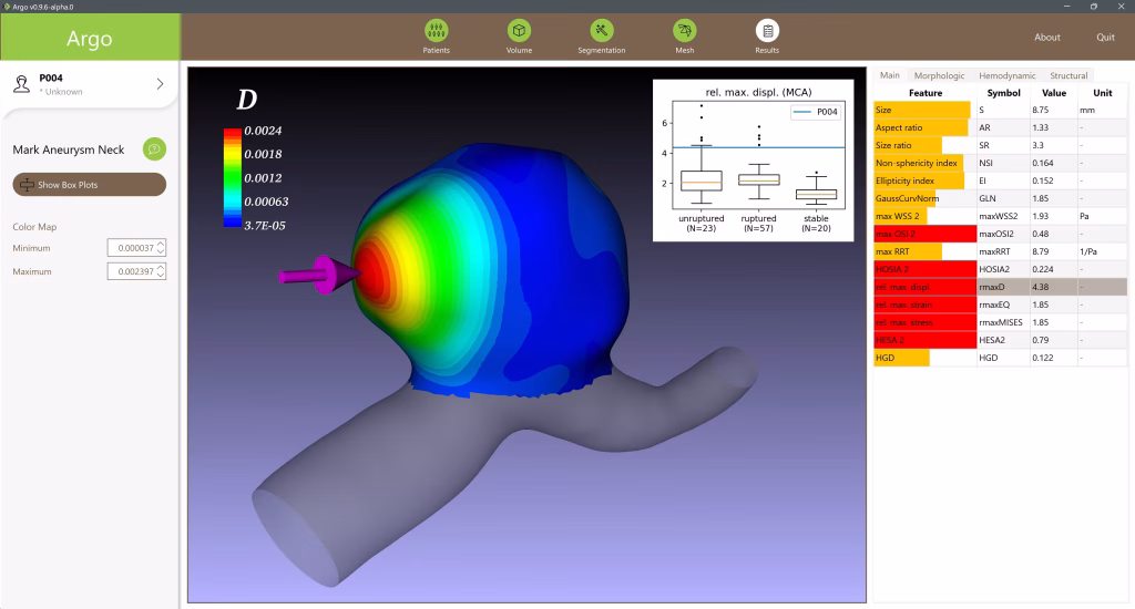 Abb. 5: Durchbiegung der Aneurysmenwand. Der Pfeil markiert die Lage des Maximums, der Boxplot zeigt den Vergleich mit der Statistik aller untersuchten Aneurysmen.