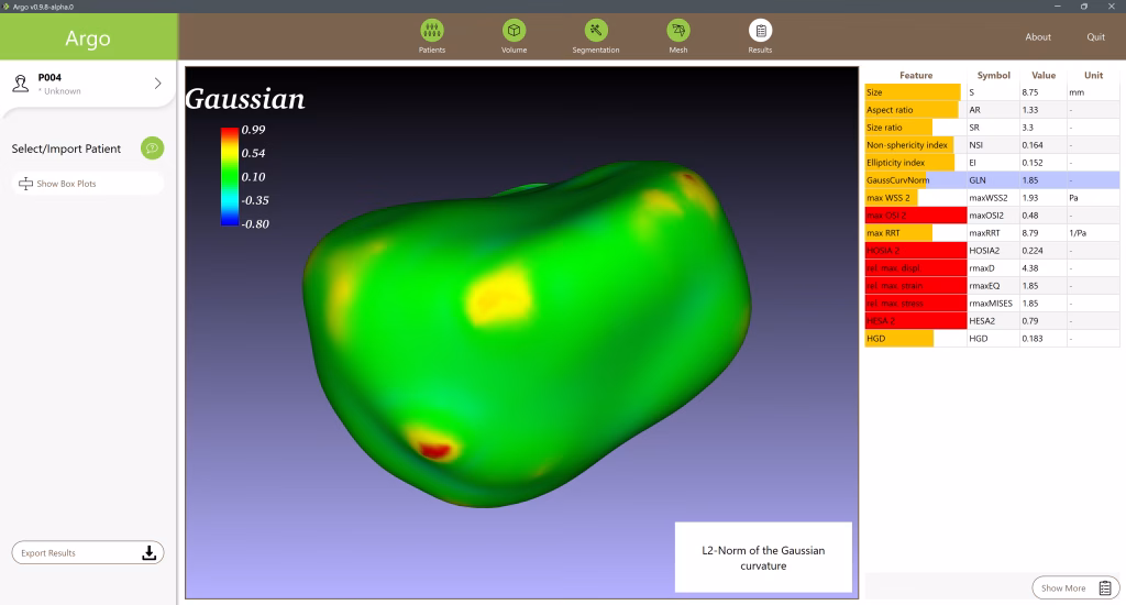 Abb. 7: Visualisierung der Gaußschen Krümmung der Aneurysmenoberfläche.