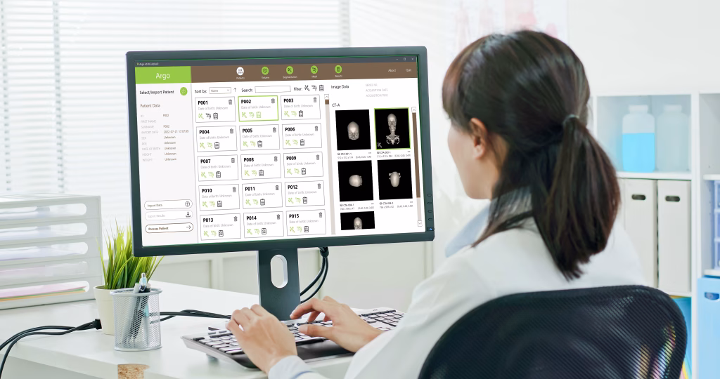 Wie Software Ärzte bei der Analyse von Gehirn-Aneurysmen unterstützt